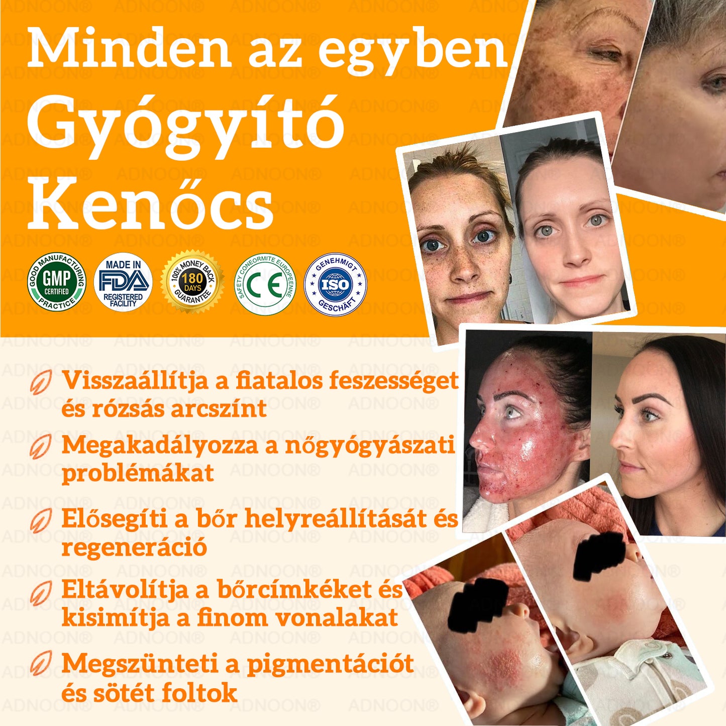 ADNOON® 💥7-napos Többhatású, Minden-egyben Bőrápoló Krém - Szakmailag támogatott az AAD által