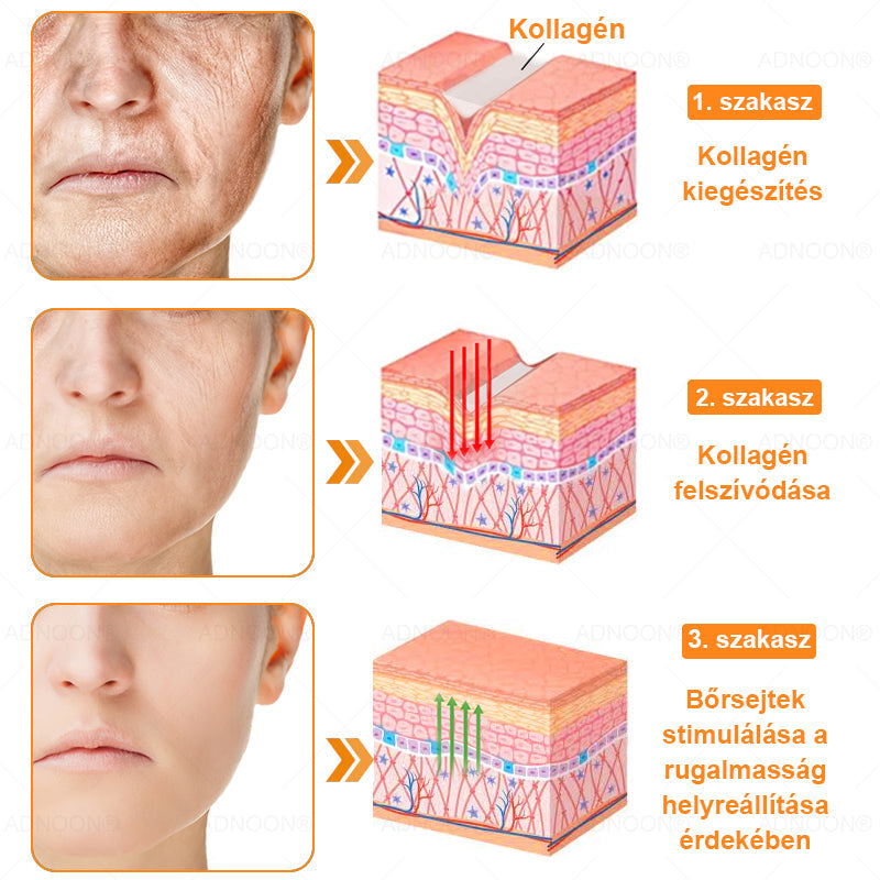 ADNOON® 🌼 7 napos erőteljes bőregészség-javító krém – ajánlja a Magyar Bőrgyógyászati Társaság (MBDT) 👨‍⚕️.